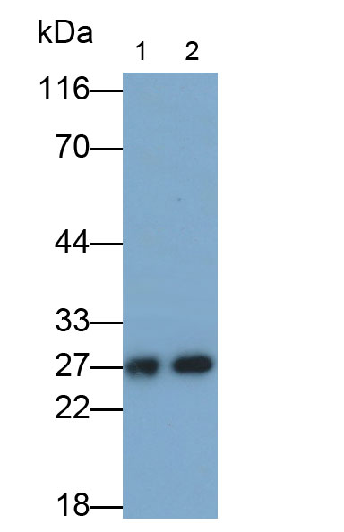 Polyclonal Antibody to Glutathione S Transferase Mu 4 (GSTm4)