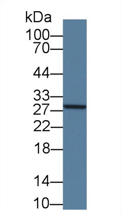 Polyclonal Antibody to Glutathione S Transferase Mu 4 (GSTm4)