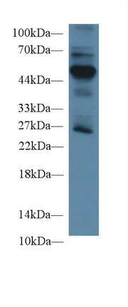 Polyclonal Antibody to Receptor For Advanced Glycation Endproducts (RAGE)