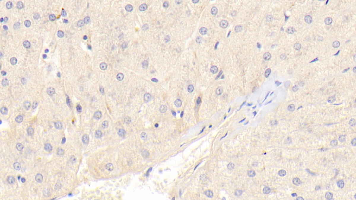 Polyclonal Antibody to Receptor For Advanced Glycation Endproducts (RAGE)