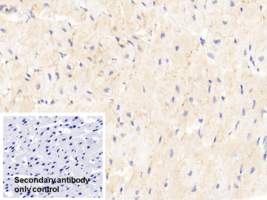 Polyclonal Antibody to Receptor For Advanced Glycation Endproducts (RAGE)