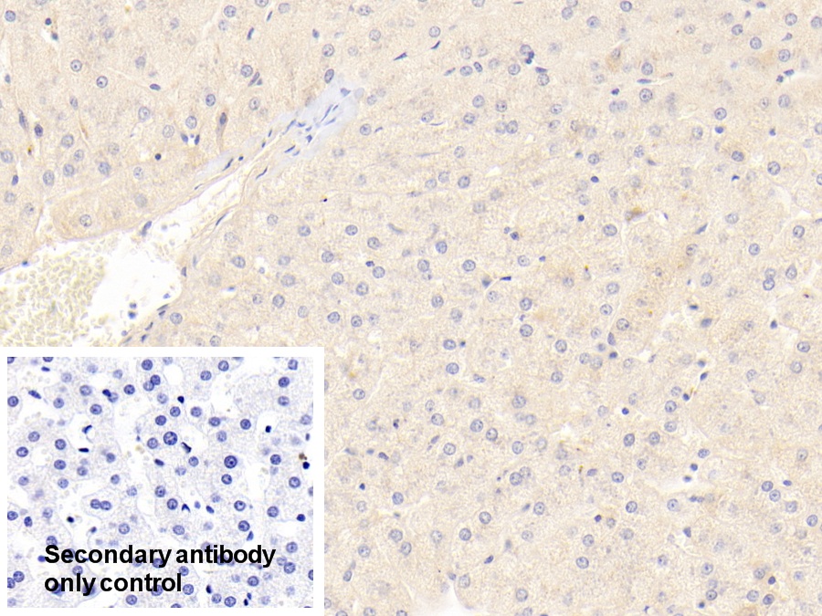 Polyclonal Antibody to Receptor For Advanced Glycation Endproducts (RAGE)