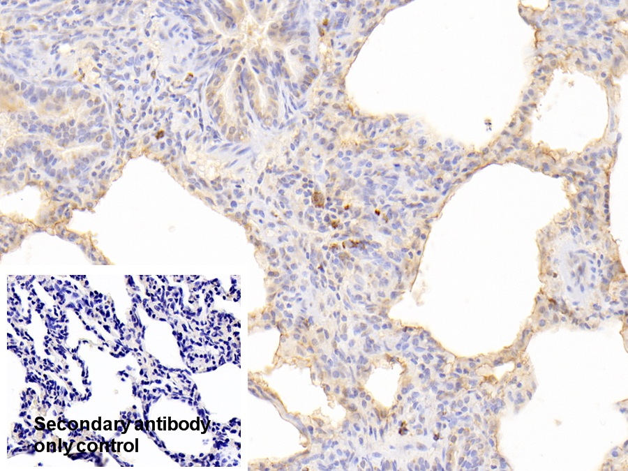 Polyclonal Antibody to Receptor For Advanced Glycation Endproducts (RAGE)