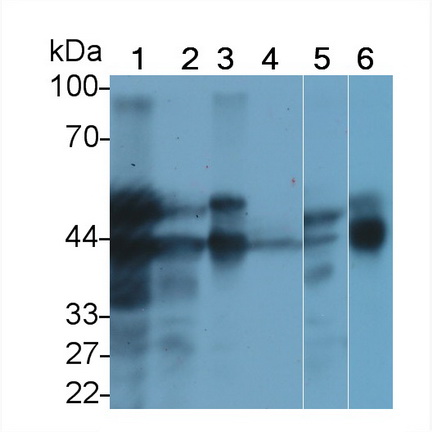 Polyclonal Antibody to Receptor For Advanced Glycation Endproducts (RAGE)