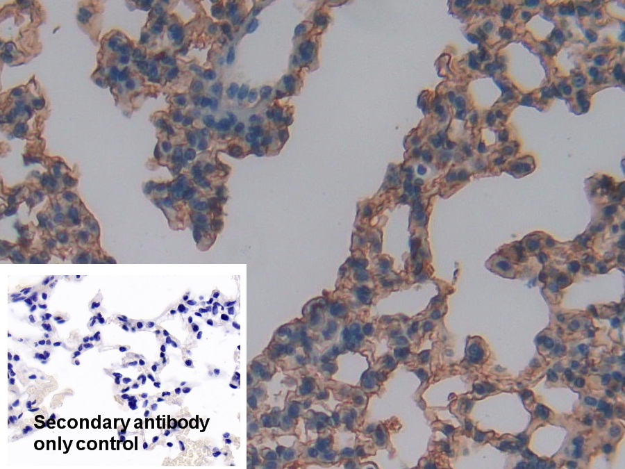 Polyclonal Antibody to Receptor For Advanced Glycation Endproducts (RAGE)