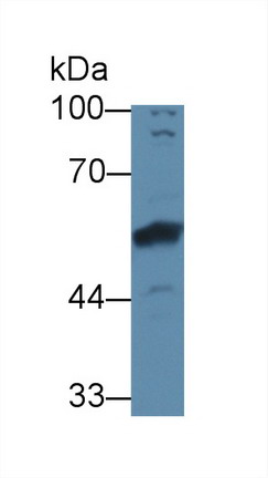 Polyclonal Antibody to Bone Morphogenetic Protein 6 (BMP6)