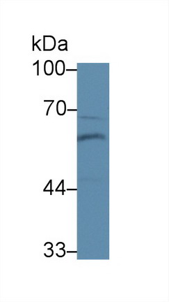 Polyclonal Antibody to Bone Morphogenetic Protein 6 (BMP6)