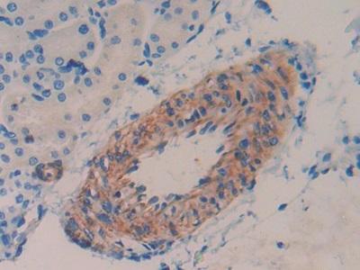 Polyclonal Antibody to Mothers Against Decapentaplegic Homolog 1 (Smad1)