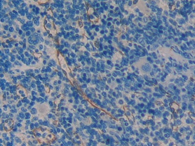 Polyclonal Antibody to Mothers Against Decapentaplegic Homolog 1 (Smad1)