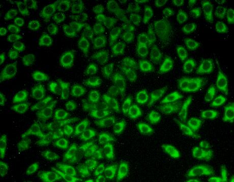 Polyclonal Antibody to Complement component 1 Q subcomponent-binding protein, mitochondrial (C1QBP)