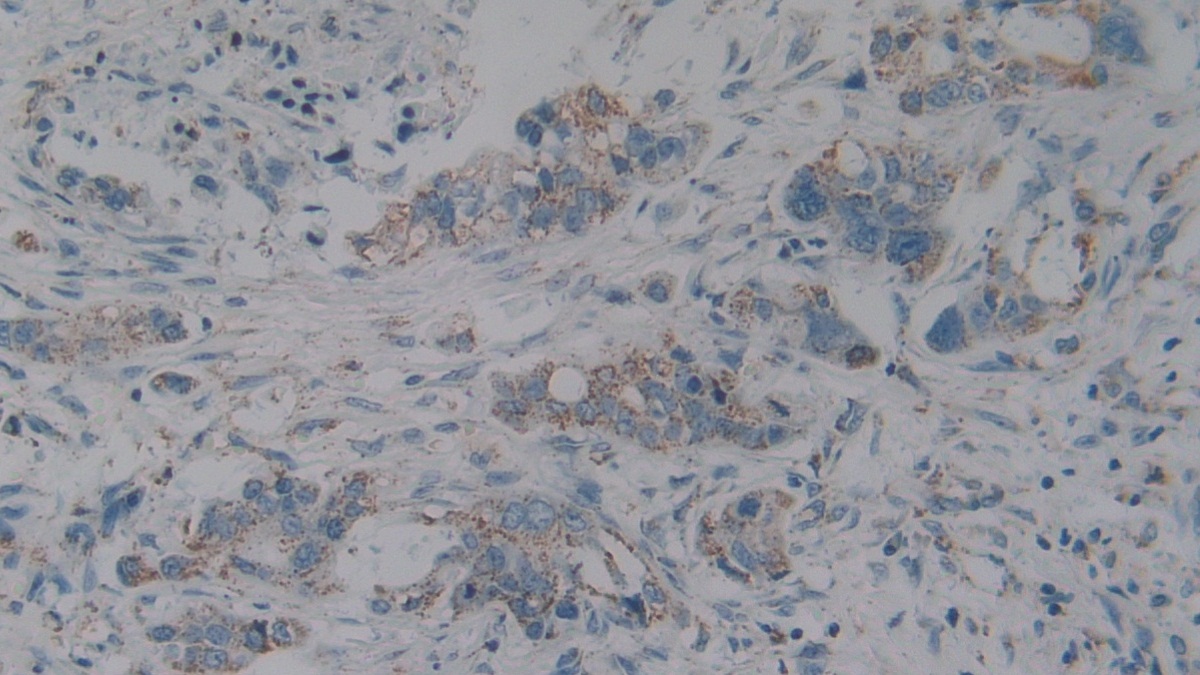 Polyclonal Antibody to Complement component 1 Q subcomponent-binding protein, mitochondrial (C1QBP)