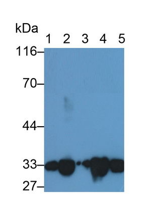 Polyclonal Antibody to Complement component 1 Q subcomponent-binding protein, mitochondrial (C1QBP)