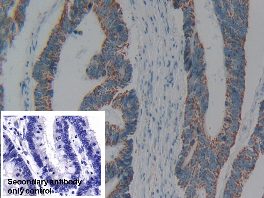 Polyclonal Antibody to Complement component 1 Q subcomponent-binding protein, mitochondrial (C1QBP)