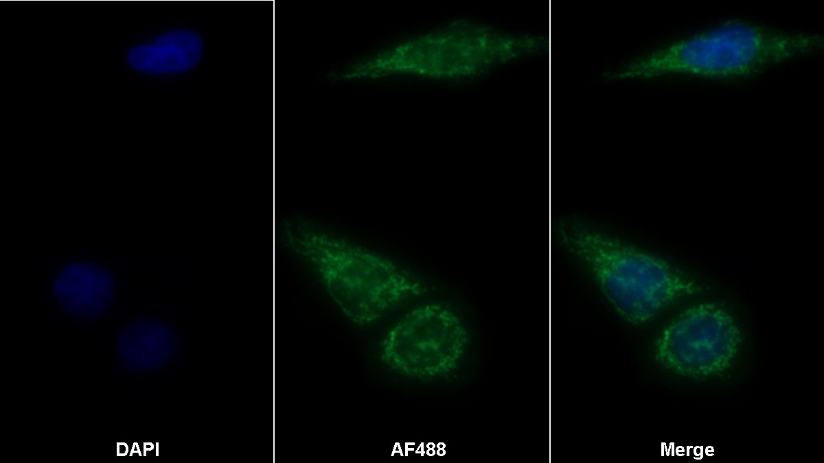 Polyclonal Antibody to Complement component 1 Q subcomponent-binding protein, mitochondrial (C1QBP)