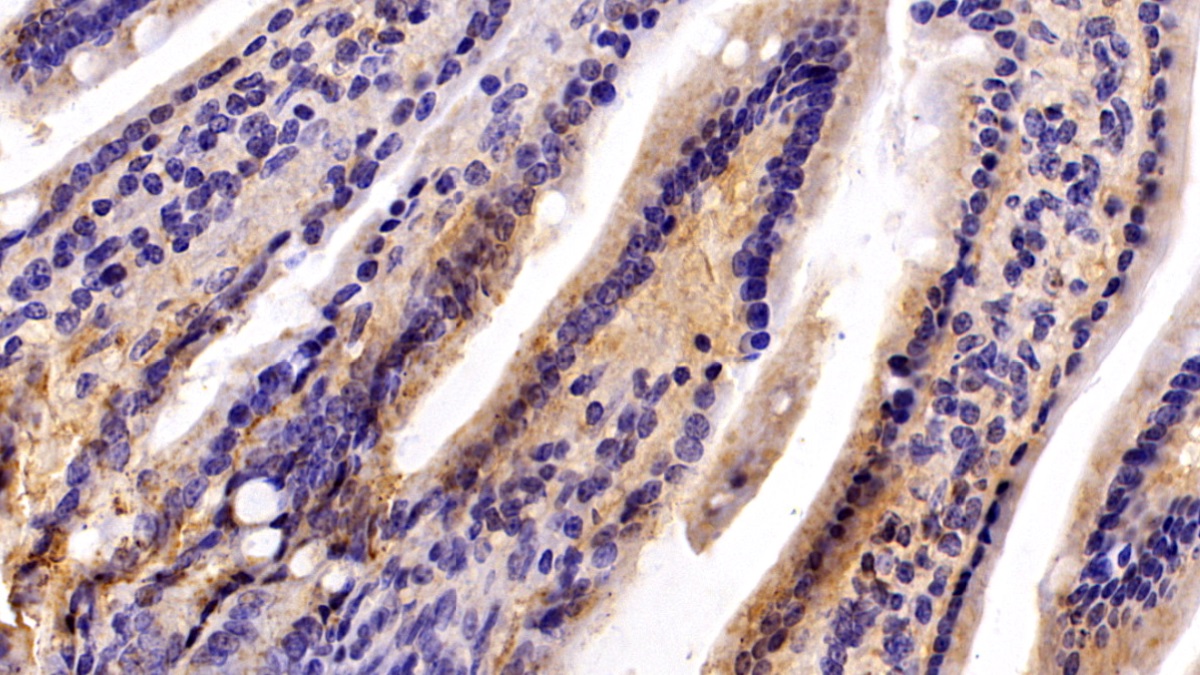 Polyclonal Antibody to Complement component 1 Q subcomponent-binding protein, mitochondrial (C1QBP)