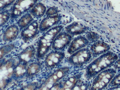 Polyclonal Antibody to Complement component 1 Q subcomponent-binding protein, mitochondrial (C1QBP)