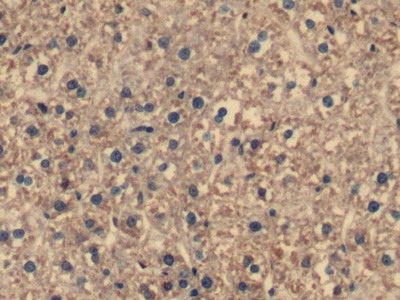 Polyclonal Antibody to Complement component 1 Q subcomponent-binding protein, mitochondrial (C1QBP)