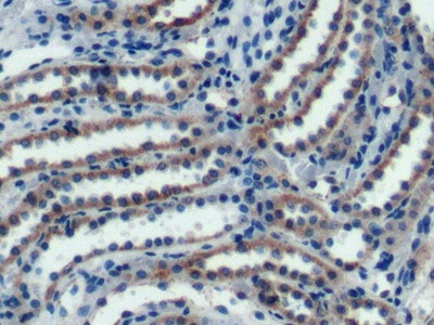 Polyclonal Antibody to Complement component 1 Q subcomponent-binding protein, mitochondrial (C1QBP)