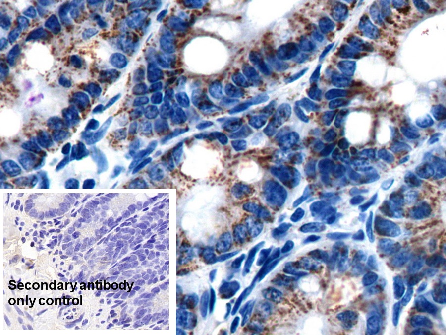 Polyclonal Antibody to Complement component 1 Q subcomponent-binding protein, mitochondrial (C1QBP)