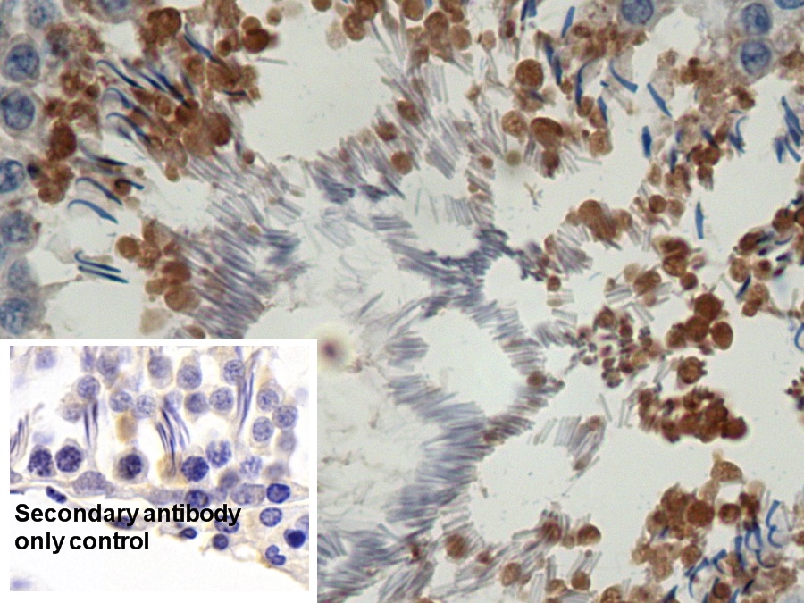 Polyclonal Antibody to Complement component 1 Q subcomponent-binding protein, mitochondrial (C1QBP)