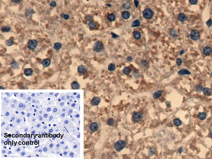 Polyclonal Antibody to Complement component 1 Q subcomponent-binding protein, mitochondrial (C1QBP)