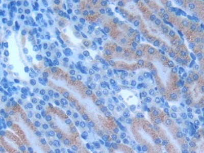 Polyclonal Antibody to Cluster Of Differentiation 28 (CD28)