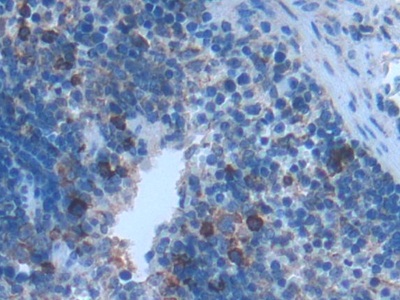 Polyclonal Antibody to Cluster Of Differentiation 28 (CD28)