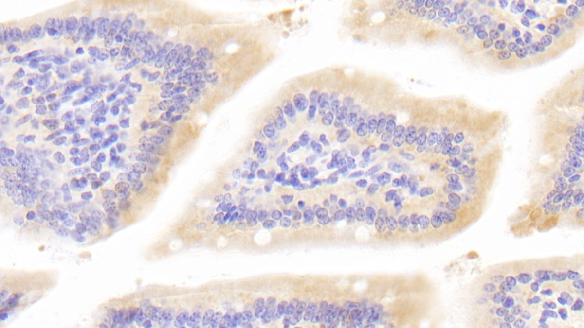 Polyclonal Antibody to Bone Morphogenetic Protein 1 (BMP1)