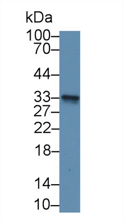 Polyclonal Antibody to Glutathione S Transferase Mu 3, Brain (GSTm3)