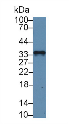 Polyclonal Antibody to Glutathione S Transferase Mu 3, Brain (GSTm3)