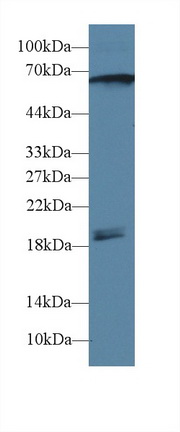 Polyclonal Antibody to Calcium/Calmodulin Dependent Protein Kinase II Gamma (CAMK2g)