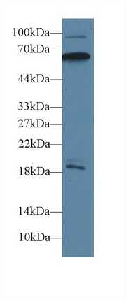 Polyclonal Antibody to Calcium/Calmodulin Dependent Protein Kinase II Gamma (CAMK2g)