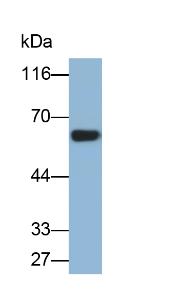 Polyclonal Antibody to Calcium/Calmodulin Dependent Protein Kinase II Gamma (CAMK2g)