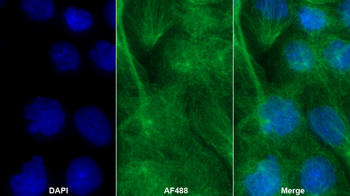 Polyclonal Antibody to Amiloride Binding Protein 1 (ABP1)