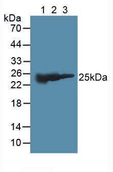 Polyclonal Antibody to Glutathione S Transferase Mu 2 (GSTM2)