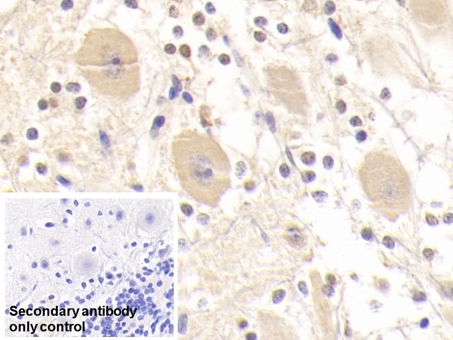 Polyclonal Antibody to Glutathione S Transferase Mu 2 (GSTM2)