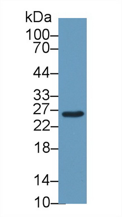 Polyclonal Antibody to Glutathione S Transferase Mu 2 (GSTM2)