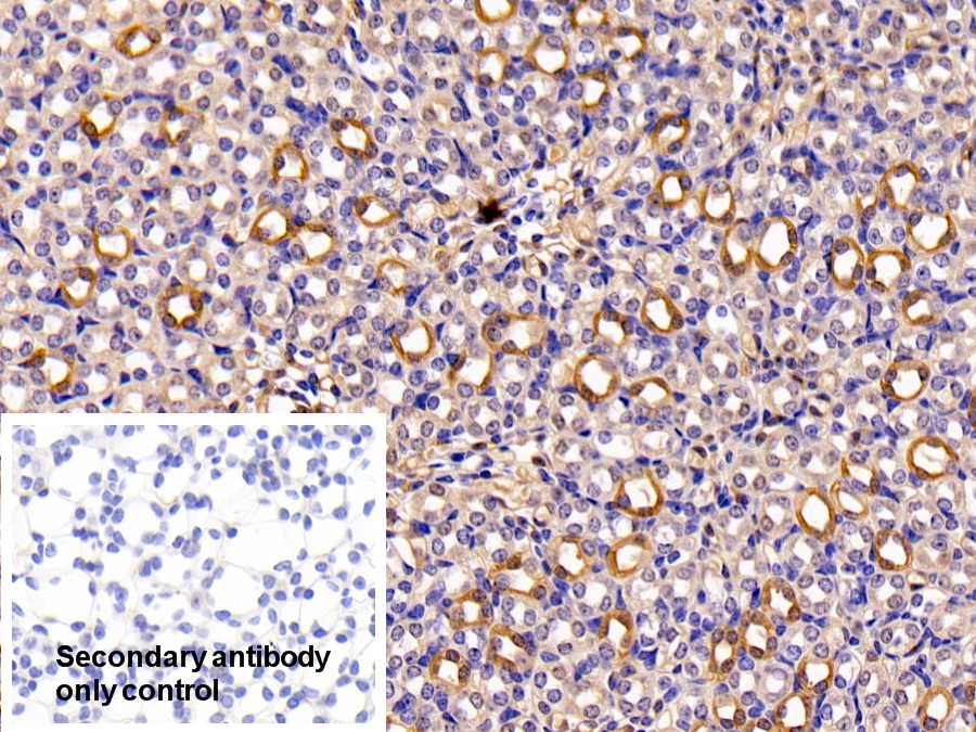 Polyclonal Antibody to Glutathione S Transferase Mu 2 (GSTM2)