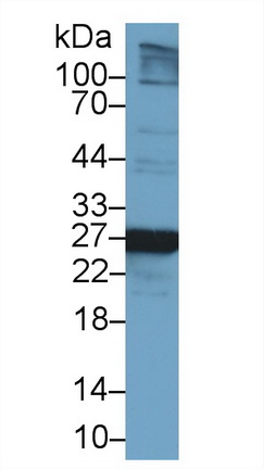 Polyclonal Antibody to Glutathione S Transferase Mu 2 (GSTM2)