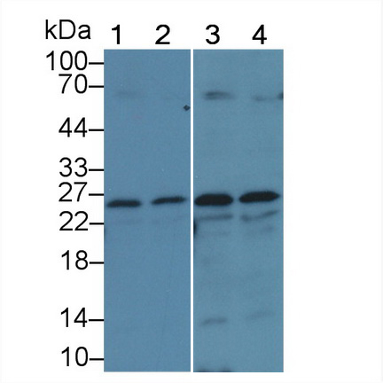 Polyclonal Antibody to Glutathione S Transferase Mu 1 (GSTM1)