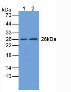 Polyclonal Antibody to Glutathione S Transferase Mu 1 (GSTM1)