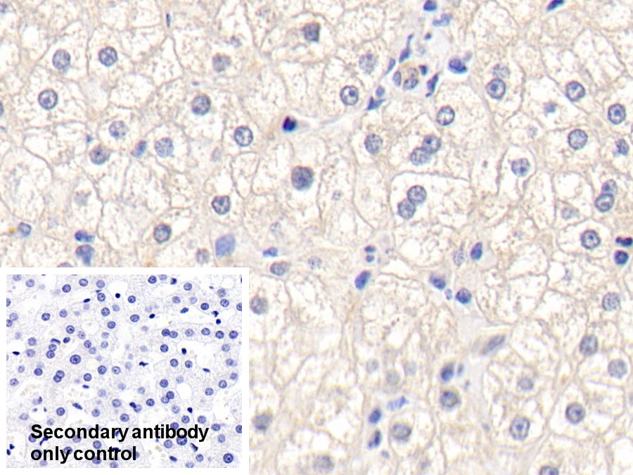 Polyclonal Antibody to Glutathione S Transferase Mu 1 (GSTM1)