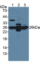 Polyclonal Antibody to Glutathione S Transferase Mu 1 (GSTM1)