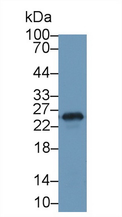 Polyclonal Antibody to Glutathione S Transferase Mu 1 (GSTM1)