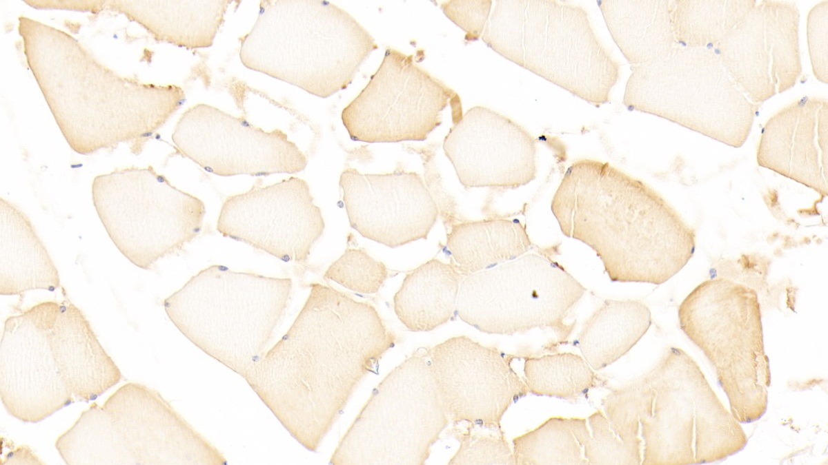 Polyclonal Antibody to Glutathione S Transferase A4 (GSTA4)