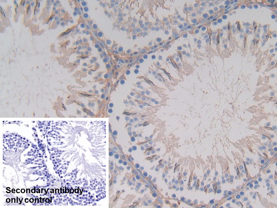 Polyclonal Antibody to Glutathione S Transferase A4 (GSTA4)