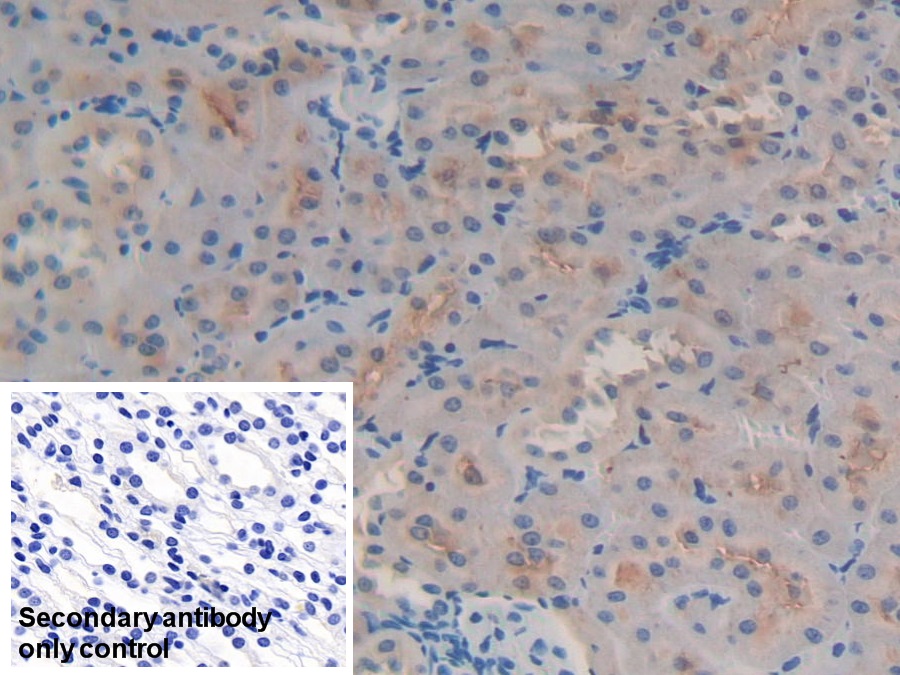 Polyclonal Antibody to Glutathione S Transferase A4 (GSTA4)