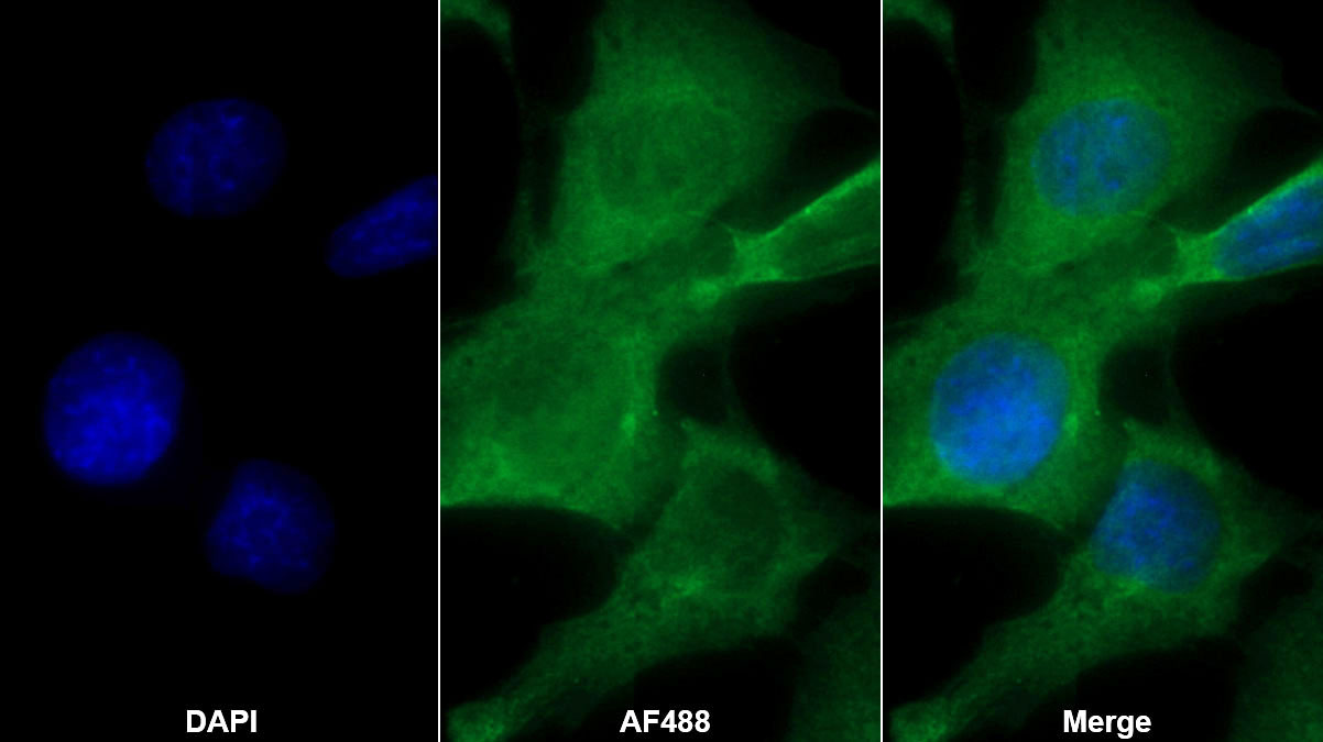 Polyclonal Antibody to Glutathione S Transferase A4 (GSTA4)