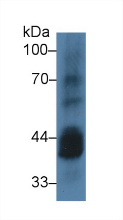 Polyclonal Antibody to Casein Kinase 1 Alpha 1 (CSNK1a1)