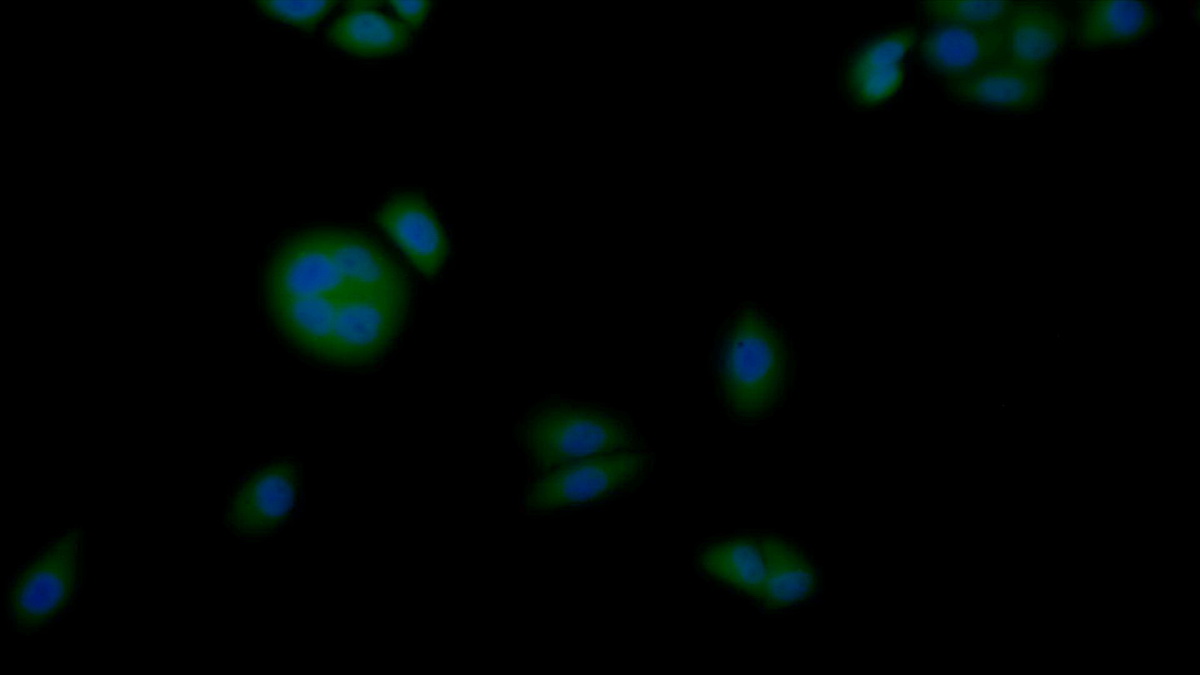 Polyclonal Antibody to Casein Kinase 1 Alpha 1 (CSNK1a1)